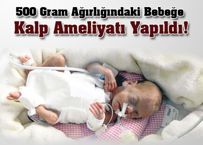 500 gram bebeğe kalp ameliyatı 500 gram bebeğe kalp ameliyatı